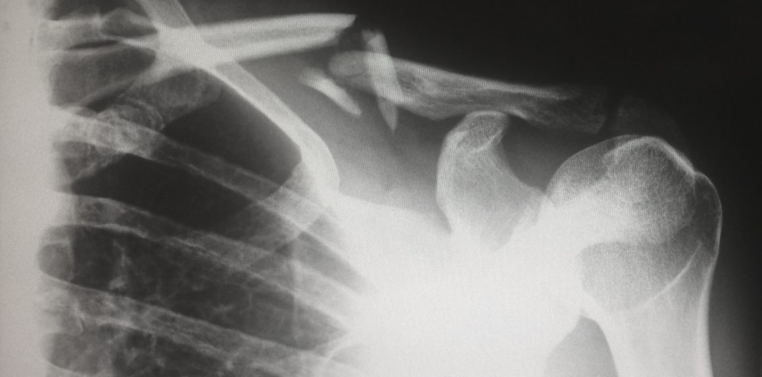best injury lawyers in philadelphia