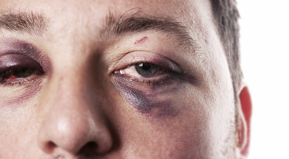 Personal Injury Caused by a Group